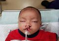 Bibir Sumbing Bisa Dicegah dengan Melakukan Ini Lo, Moms!