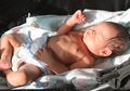 Bayi Lahir 2 Kilogram Karena Saat Hamil Pertumbuhannya Terhambat