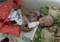 Bayi Masuk Rumah Sakit karena Diberi Susu Kental Manis, Dokter : Bayi yang Diberi Susu Kental Manis Berisiko Alami Gangguan Ini
