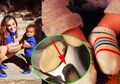 Ibu ini Masukkan Kentang ke Dalam Kaus Kaki Anaknya yang Demam, Hasilnya Mengejutkan