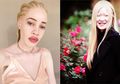 Pesona Penderita Albino Dari Berbagai Ras Ini Super Mengagumkan