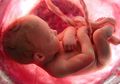 Antisipasi Anak Lahir dengan Kebutuhan Khusus, Perhatikan Hal Ini Moms