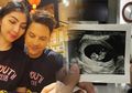 Istri Lucky Perdana Segera Melahirkan, Warganet Fokus Pada Bentuk Perutnya
