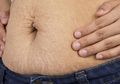 Kurangi Stretch Mark dan Bekas Luka dengan 4 Perawatan Mudah dengan Minyak Kelapa