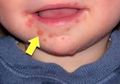 Moms Sering Cium Bibir Bayi Karena Gemas? Ketahui Dulu Risikonya!