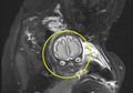 Bukannya Kaget, Pasangan Ini Justru Terpingkal-pingkal Setelah Melihat Foto MRI Anaknya