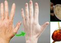 Tidak Mahal, Hanya dengan Gunakan 3 Bahan Alami Ini Keriput di Tangan akan Segera Hilang