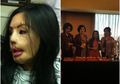 Kebangkitan Hidup Lisa 'Face Off' Setelah 14 Tahun Hidup dengan Wajah Penuh Luka Bakar