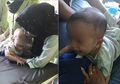 Usai Mendapatkan Imunisasi Bayi Ini Harus Dioperasi, Apa Sebabnya?