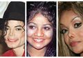 Operasi Plastik Agar Karir Sukses, Wajah Adik Michael Jackson ini Malah Dianggap Aneh