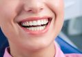 4 Bahan Alami yang Bisa Digunakan untuk Membersihkan Karang Gigi
