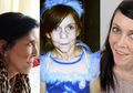 Kisah Ibu dan Anak yang Memiliki Wajah Keriput Layaknya Nenek-nenek