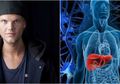 DJ Avicii Derita Penyakit Pankreatitis Akut, Gejalanya Mirip dengan Penyakit 'Biasa'