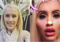 Berjuang Melawan Kanker, Wanita Ini Lakukan Operasi agar Mirip Barbie dari Gelontoran Uang Sugar Daddy-nya