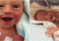 Dianggap Lemah dan Rentan Sakit Karena Lahir Prematur, Nyatanya 7 Bayi ini Bisa Tersenyum dan Hidup Bahagia