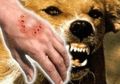 619 Orang Jadi Korban Serangan Anjing Gila, 6 Orang Meninggal: Segera Lakukan Ini jika Digigit Hewan Rabies