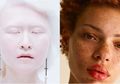7 Model Ini Buktikan Bahwa Setiap Wanita Itu Cantik Asal Ia Percaya Diri dan Menjadi Diri Sendiri