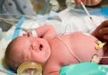 Bayi Tidak Boleh Sakit, Jika Terjadi Penyebabnya Ada Pada Orangtua