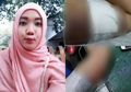 Lepas KB Implan di Lengannya, Inilah yang Terjadi pada Wanita Ini