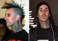 Duh, Travis Barker Mengidap Pembekuan Darah di Kedua Tangannya