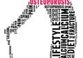 Meski Lebih Banyak Wanita, Osteoporosis Juga Menyerang Para Pria, Ini Faktor Penyebabnya