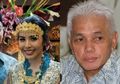 Berbagai Kebiasaan Penyebab Kanker Kulit, Seperti Menantu Hatta Rajasa