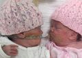 Bikin Nangis, Inilah Momen Mengharukan Ketika Bayi Kembar Memeluk Kembarannya yang Sedang Sekarat