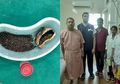 Ada 4.100 Batu Empedu dalam Tubuhnya, Ini yang Ia Rasakan Bertahun-tahun