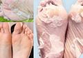 Hanya Butuh Semalam, Ini Cara Mudah Mengusir Kulit Kasar di Kaki dan Membuatnya Semulus Kaki Bayi