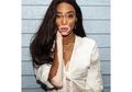 Dulu Dibully Karena Kulitnya, Winnie Harlow Kini Jadi Model Victoria’s Secret