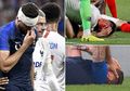 Ngeri! Kepala Giroud Bocor ketika Prancis Bertanding Melawan USA