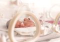 Beberapa Hal Ini Penyebab Bayi Lahir Prematur, Perlu Diwaspadai Moms!