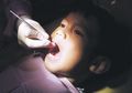 Awas, Perhatikan Konsumsi Anak Jika Tak Ingin Giginya Terus Berlubang