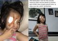 Sering Main Gadget, Anak Ini Harus Diterapi Tiga Jam Setiap Hari