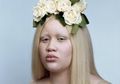 Di-Bully karena Albino, Perempuan Ini Percaya Diri di Dunia Modelling