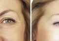 Tak Perlu Botox, Cukup dengan Bahan Alami Ini Moms Dapat Hilangkan Keriput
