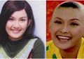Sempat Koma Hingga 5 Bulan, Penyakit yang Renggut Nyawa Sukma Ayu Bisa Dipicu Makanan Enak Ini