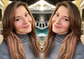 Tiba-tiba Muncul Pakai Arm Sling, Tamara Bleszynski Buat Cemas Netizen