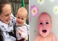 Haru! Bayi Ini Sembuh Penyakit Kulit dengan Dimandikan ASI oleh Ibunya