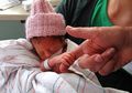 Berat Badan Lahir Si Kecil Rendah? Waspadai Beberapa Risiko Ini Moms