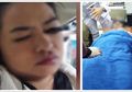 Pakai Eyeliner di Mobil, Gadis Ini Nyaris Buta Setelah Kejadian Tragis