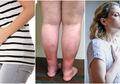 Jangan Abaikan Rasa Sakit & Perubahan Tubuh Ini, Terlebih Perempuan!