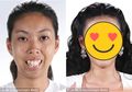Jadi Sasaran Bullying Sejak Kecil, Lihat Penampilan Memukau Perempuan Ini Setelah Operasi Wajah