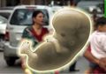 Usia Kandungannya Mencapai 38 Tahun, Seorang Perempuan Tolak Operasi dan Alami Hal Mengerikan