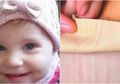 Ngeri! Bayi 15 Bulan Meninggal Dunia Setelah Terkena Koyo Milik Ibunya