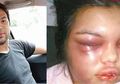 Hanya Karena Like Banyak di Facebook, Perempuan Ini Selalu Dipukuli Suaminya!