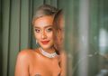 Tak Perlu Malu, Model Sekelas Kimmy Jayanti Saja Punya Kapalan di Kaki!
