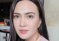 Tunjukan Foto Wajah Penuh Jerawat, Shandy Aulia: Saya Bukan Bidadari