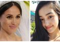 Jadi Tren Make Up Kekinian, Ini 5 Fakta Freckles atau Kulit Berbintik Coklat yang Digandrungi para Artis