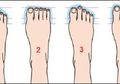 Rupanya Bentuk Kaki Bisa Tunjukkan Kepribadian Kita Lho, Coba Cek Bentuk Kaki Anda!